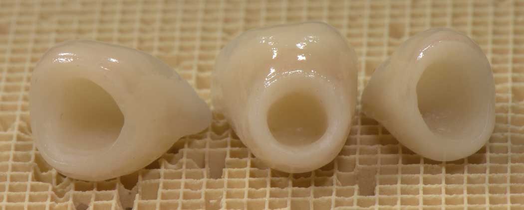 implants en céramique pure